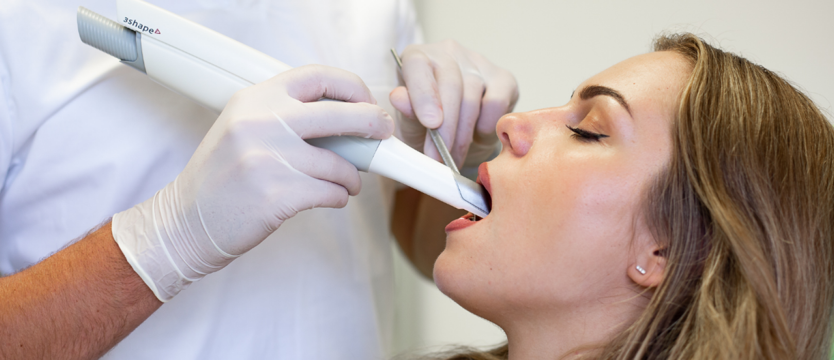 Digitalno uzimanje otisaka intraoralnim skenerom